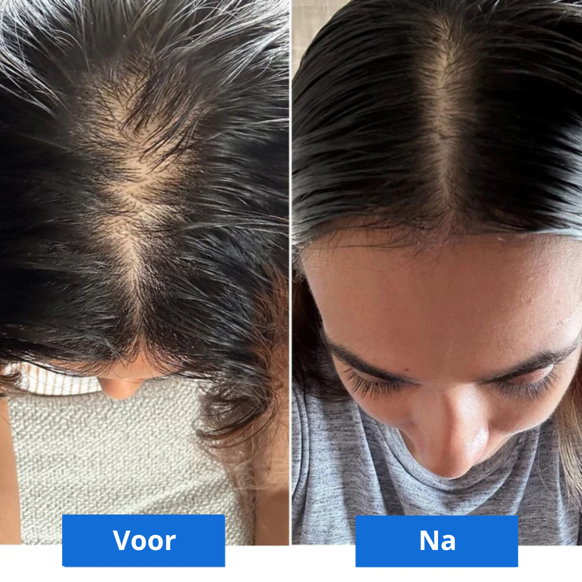 Scalp Bliss – Luxe Hoofdmassage voor Ontspanning