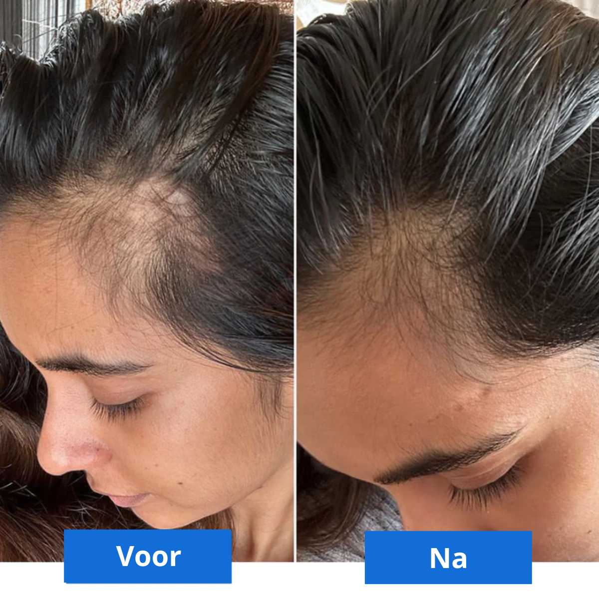Scalp Bliss – Luxe Hoofdmassage voor Ontspanning