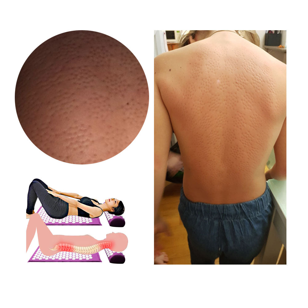 RelaxPress – Acupressuur Yogamat en Kussenset