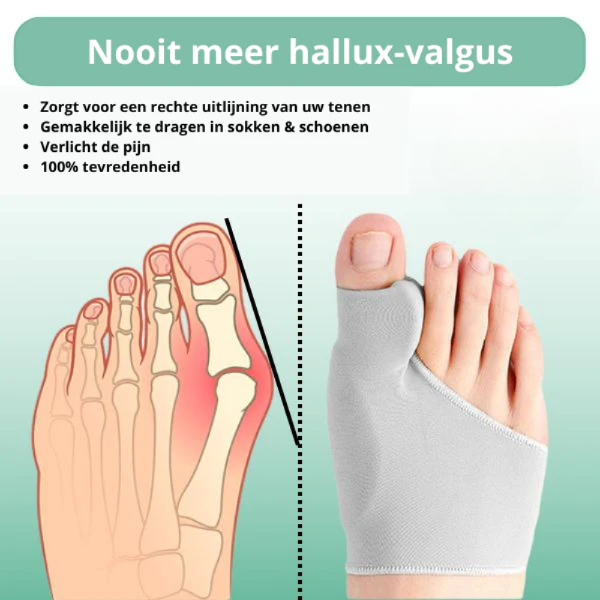 CompressCare Teencorrector tegen Hallux Valgus – Comfort voor Jouw Voeten