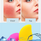 FaceGlide - Luxe IJsroller voor Stralende Huid